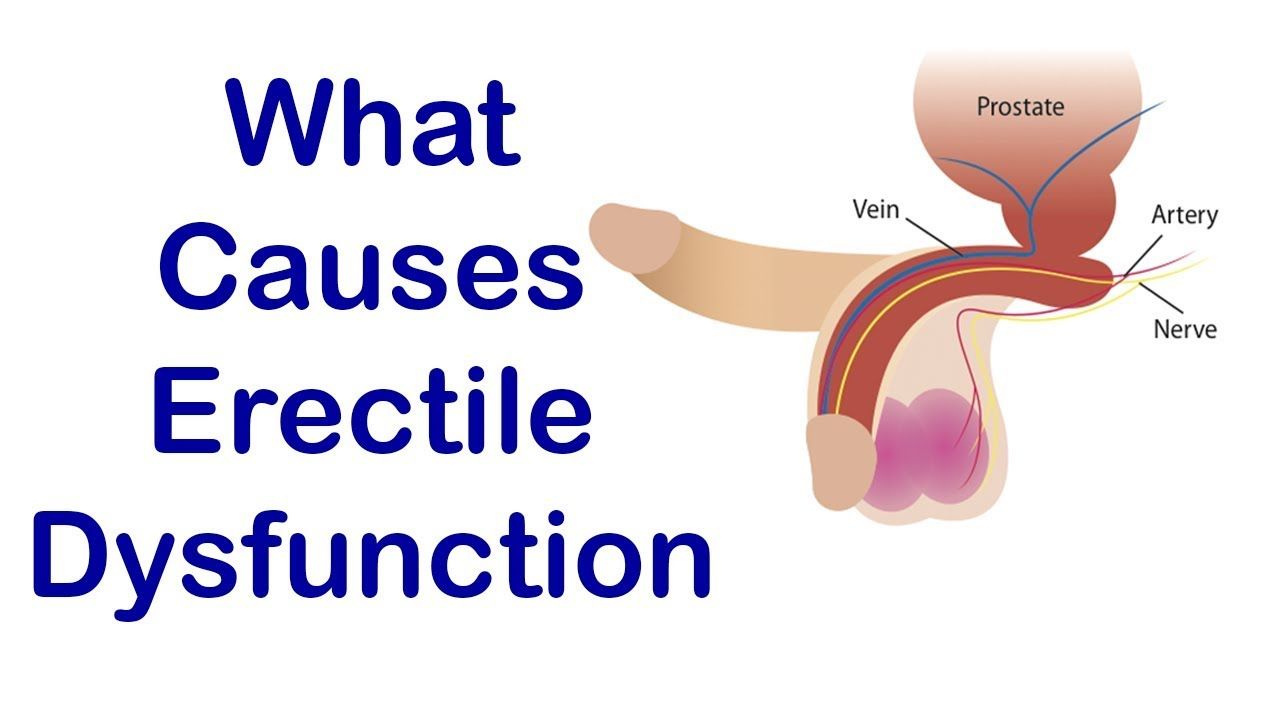 what causes erectile dysfunctions